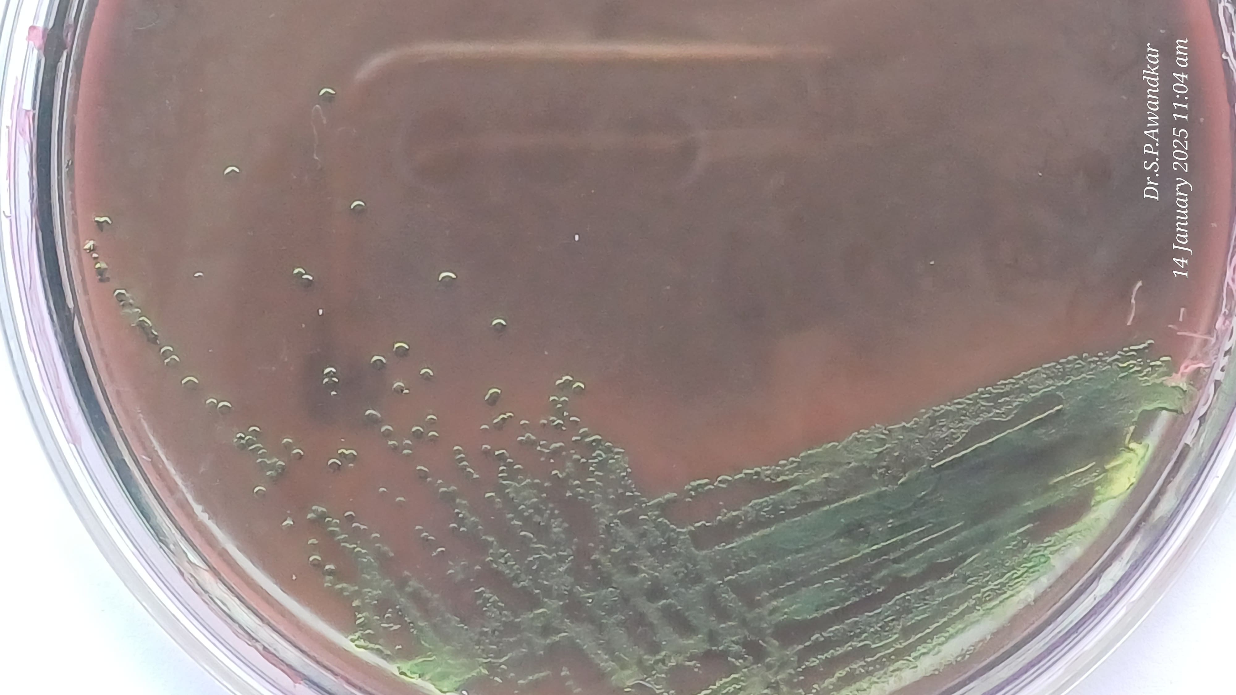 19. Avian Pathogenic E. Coli